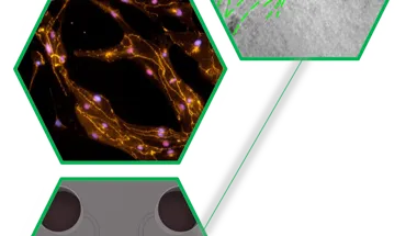 Perfusable, stem cells-derived blood vessels in custom lab-on-chip devices