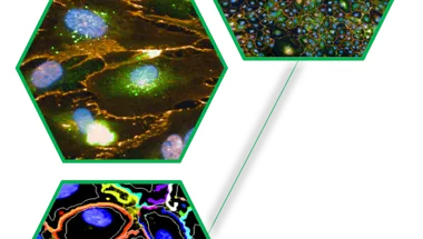 Developing advanced image