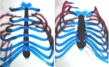 Skeletal Development: Making and Shaping Bones