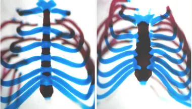 Skeletal Development: Making and Shaping Bones
