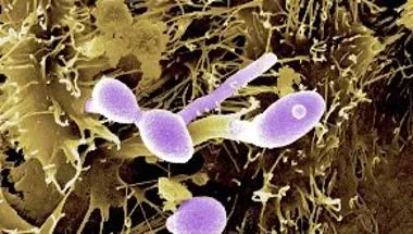 Candida immunity