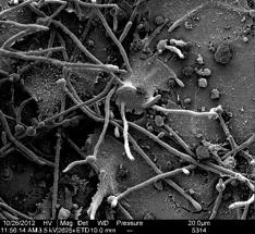 Candida pathogenicity - candidalysin