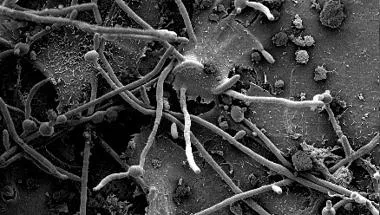 Candida pathogenicity - candidalysin