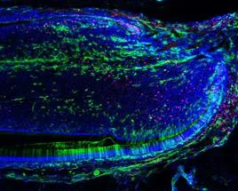 A histology of a repaired tooth