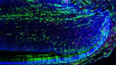 A histology of a repaired tooth
