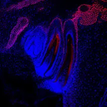 Sox2 stem/progenitor cells (pink) in the embryonic snake jaw 