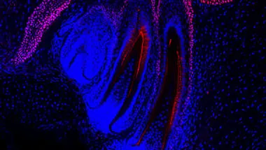 Sox2 stem/progenitor cells (pink) in the embryonic snake jaw