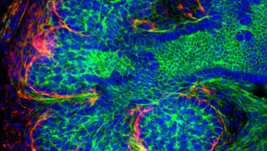 Laminin (red) highlighting the basement membrane around a developing submandibular gland