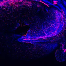Murine ear drum with endoderm and blood vessels in pink
