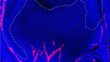 Tooth Morphogenesis and Differentiation conference