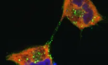 HeLa cells with dapi-stained nuclei (blue) and expressing HIV-1 Gag (green) and APOBEC3G (Red)