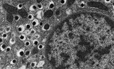 Diabetes in microscope