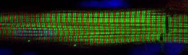 Cardiomyocyte