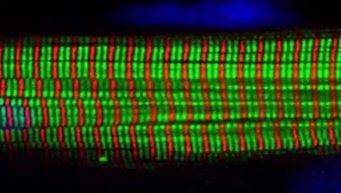 Cardiomyocyte