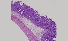 Bacteria under microscope