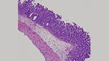 Bacteria under microscope