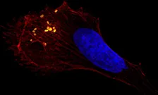 Salmonella under microscope