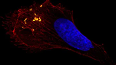 Salmonella under microscope