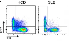 B cells & lupus Spencer Lab
