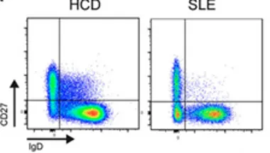 B cells & lupus Spencer Lab
