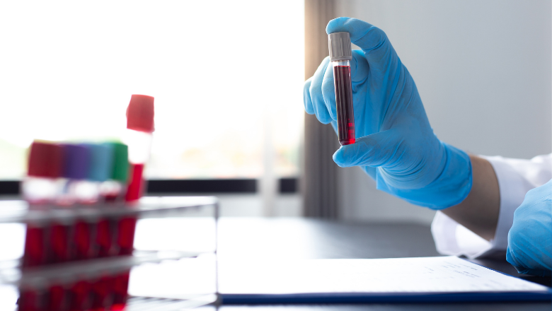 Blood samples for laboratory test