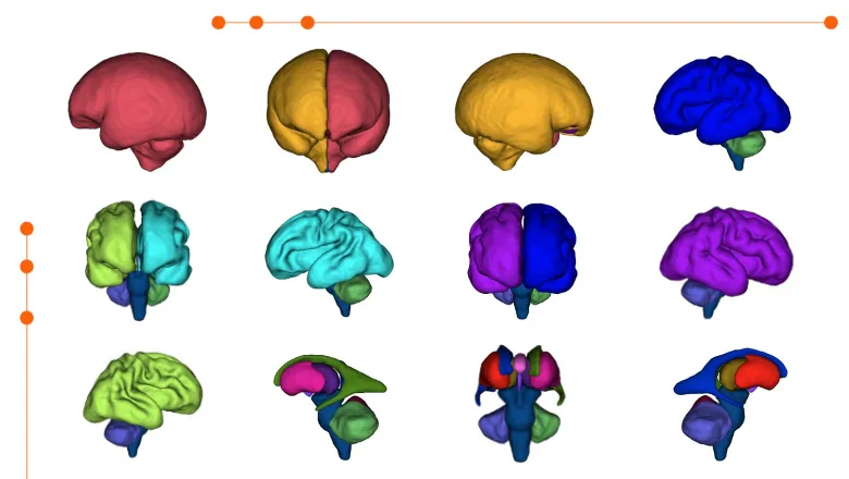 MRI Scans of foetuses with CHD taken in the study.