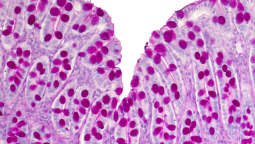 IBD and Complex Genetics Group
