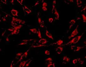 Complex V expression in N27 rat mesencephalic neurones