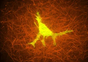 A cell embedded in a collagen matrix