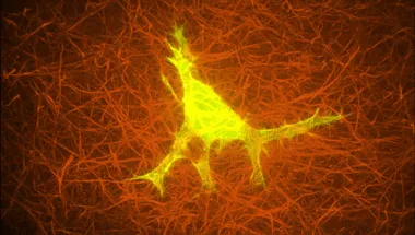 A cell embedded in a collagen matrix