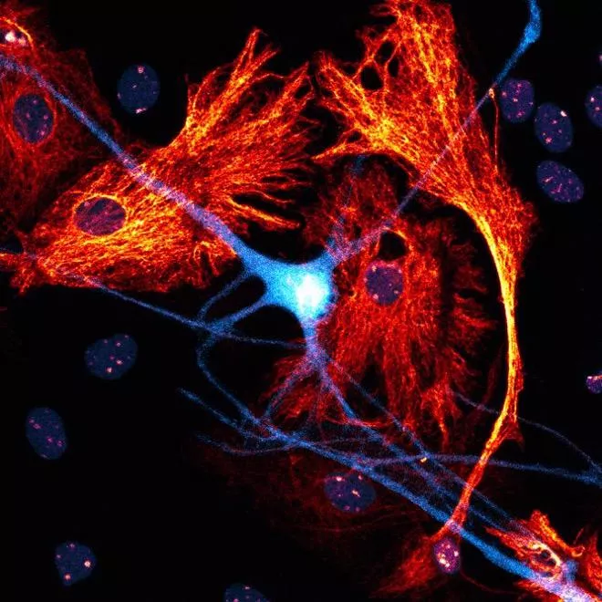 A song of Ice and Fire- Motor neurons (blue) and astrocytes (red)  grown from the iPSCs of patients with ALS