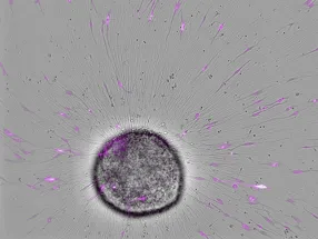 Defining cell behaviour of patient-derived brain tumour cells using high content imaging