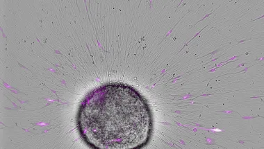 Defining cell behaviour of patient-derived brain tumour cells using high content imaging