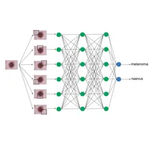 Lynch-project_ai