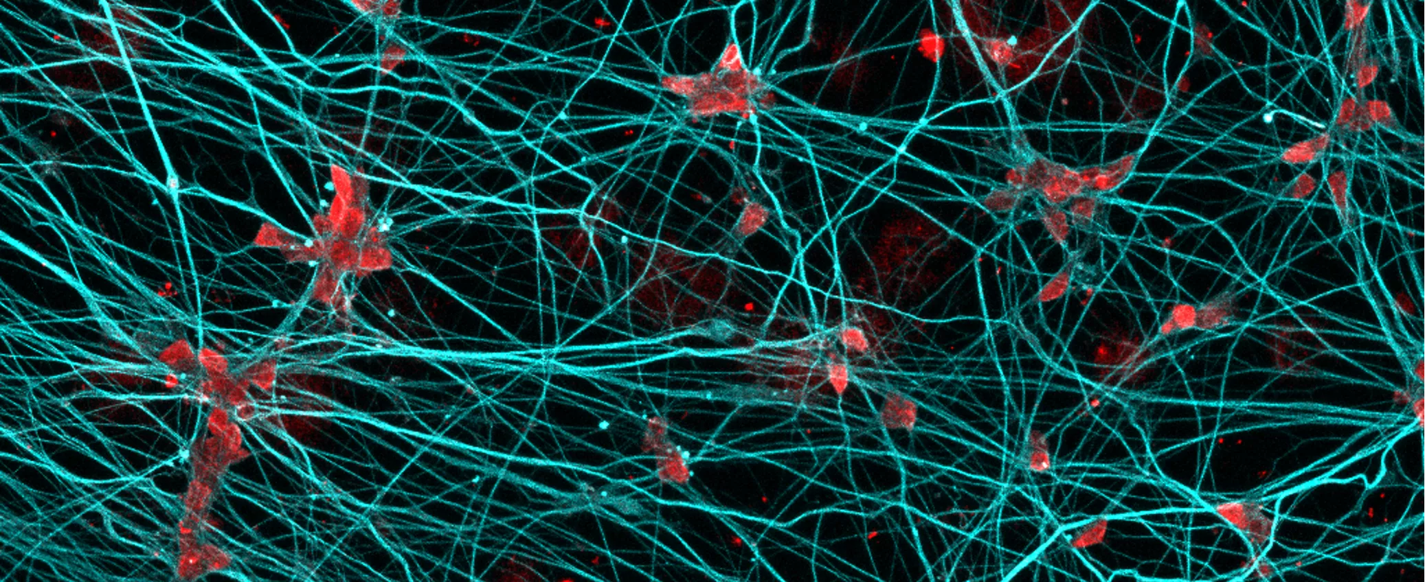Motor neurons grown in a dish