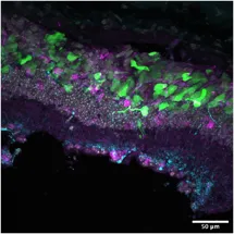 Photoreceptor transplantation to restore sight