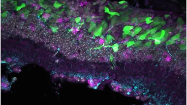 Photoreceptor transplantation to restore sight