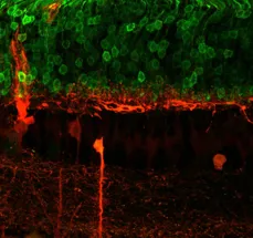 Synaptic connectivity in degeneration and repair