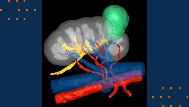 Innersight3D Kidney