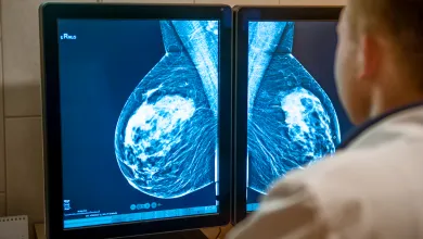 Mammogram