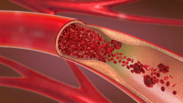 NIHR-BHF Coronary Microvascular Dysfunction Workstream