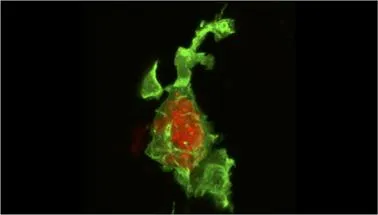 Understanding Shigella persistent infection and antimicrobial resistance