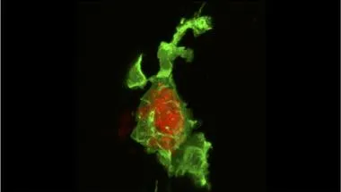 Understanding Shigella persistent infection and antimicrobial resistance