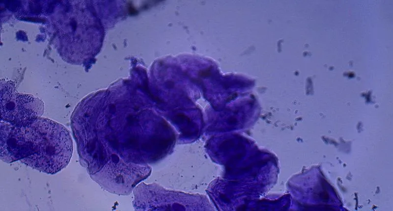 cheek cells