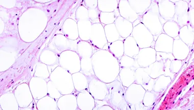 adipose fat cells