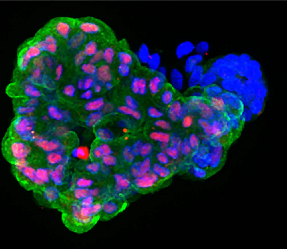 Early pancreatic organoid made from iPSCs