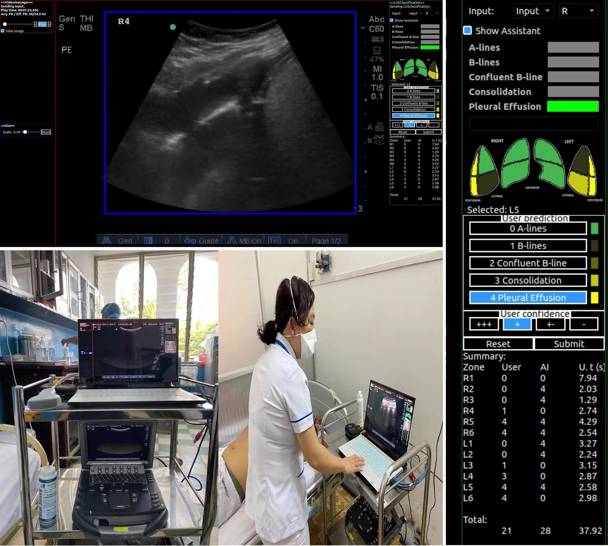 ai to support lung ultrsound - in article image