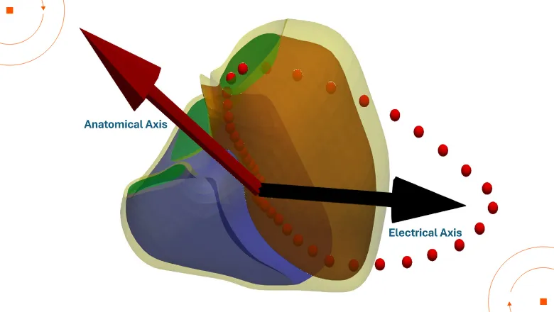 A representation of a three-dimensional biventricular anatomy reconstructed from cardiac MRI scans, showing the spatial relationship between anatomical and electrical axes in a large population-based cohort (~40,000 UK Biobank participants).