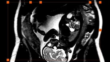 Early Life Imaging