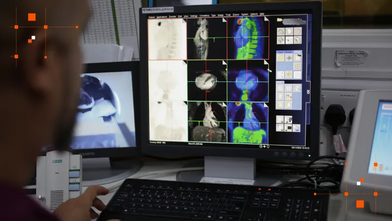 Man looking at a different angles of a PET-CT scan of a torso on a computer. 